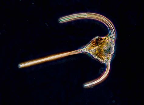 Armored Dinoflagellate: This Microscopic Wonder Will Make You Question Everything You Know About Single-Celled Life!