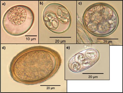  Eimeria! Een microscopische parasiet met een ongewoon groot effect op zijn gastheer