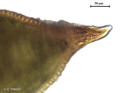  Udonella! Een microscopisch wonder met een eetlust die indruk maakt