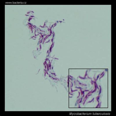  Uroleptus: Een Microscopisch Wonder met Snelle Bewegingen en Gecompliceerde Vormen!