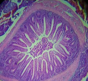  Urosporidium! Een Microscopisch Wonder dat zich Verstopt in de Darma van Vissen